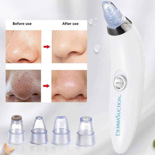 Blacked head remover vacuum device